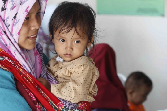 Anak-anak di Pandeglang terindikasi malnutrisi