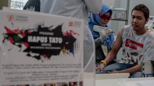 Hijrah Fest 2018 Tawarkan Layanan Hapus Tatto Gratis