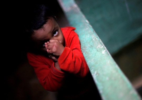 Mengobati Penyakit dengan Terapi Sengat Lebah dari Mesir