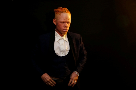 Saat Penderita Albino Kenya Berlenggok di Atas Catwalk