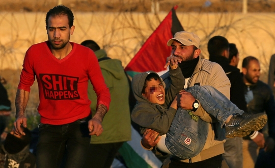 Nestapa Bocah Palestina Penglihatannya Terenggut Serpihan Gas Air Mata Israel
