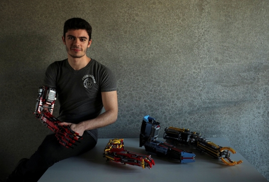David Aguliar, Pria Spanyol yang Gunakan Tangan Palsu Dari Lego