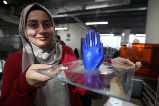 Berkat Teknologi 3D Korban Perang di Yaman Dapatkan Kembali Anggota Tubuhnya