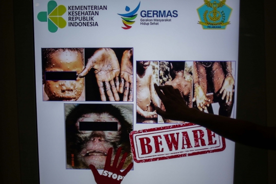 Antisipasi Cacar Monyet, Petugas Bandara Soekarno-Hatta Periksa Suhu Badan Penumpang