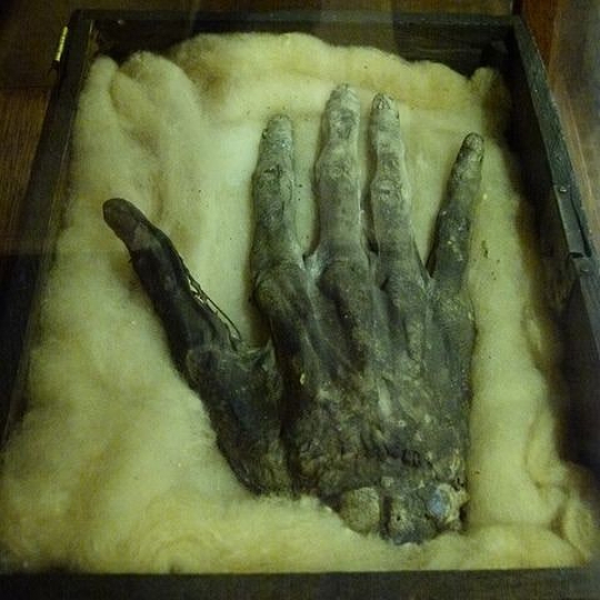 Hand of Glory, Sepotong Tangan Keramat Koleksi Museum di Inggris