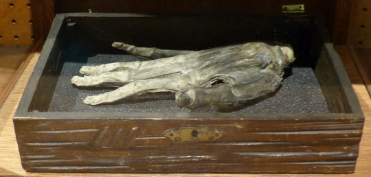 Hand of Glory, Sepotong Tangan Keramat Koleksi Museum di Inggris