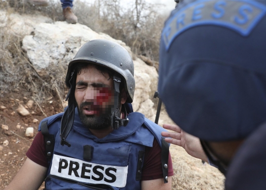 Liput Bentrok di Perbatasan, Jurnalis Palestina Tertembak Polisi Israel