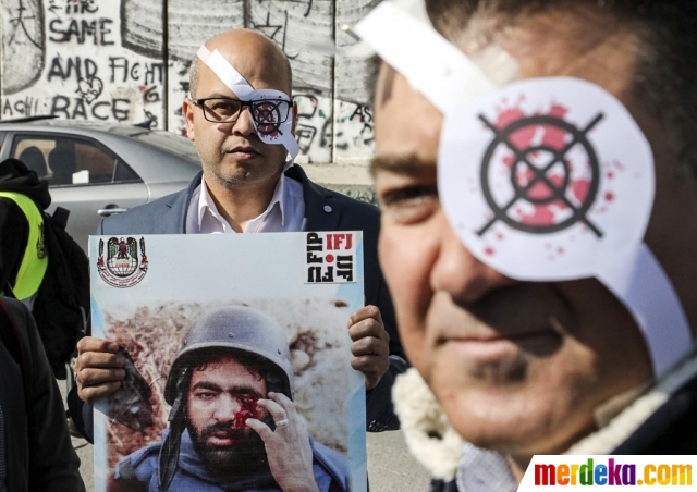 Jurnalis Palestina menggelar aksi solidaritas untuk Mu'ath Amarneh di kota Nablus, Tepi Barat, Minggu (17/11/2019). Mereka mengutuk kekerasan polisi Israel yang membuat wartawan foto Mu’ath Amaneh buta setelah matanya tertembak saat meliput aksi protes warga Palestina terhadap pemukiman Yahudi.
