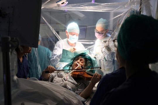 Kisah Pasien di Inggris Mainkan Biola Saat Operasi Tumor Otak
