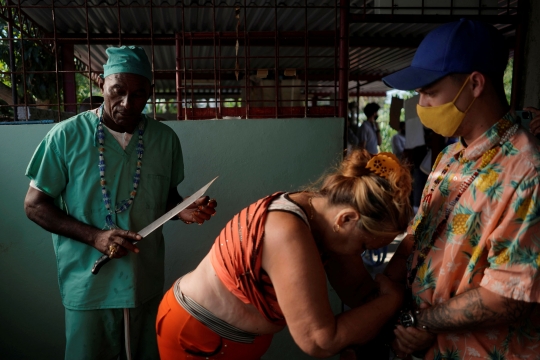 Bikin Ngeri, Tabib di Kuba Ini Operasi Pasiennya Pakai Golok