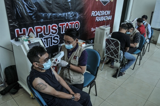 Layanan Hapus Tato Gratis