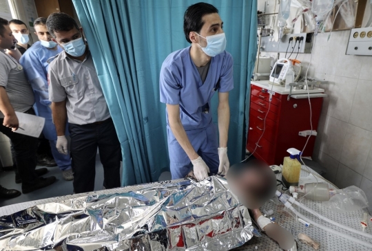 Ekspresi Anak-Anak Palestina yang Terluka dan Trauma Oleh Serangan Udara Israel