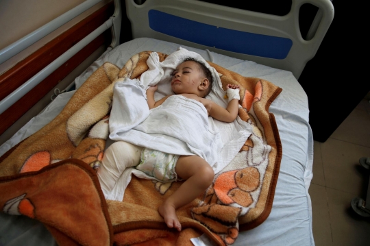Nasib Malang Bayi Korban Serangan Rudal Israel di Gaza