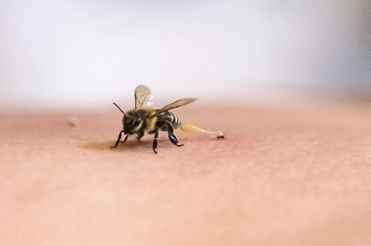 Mengobati Rematik dengan Terapi Sengat Lebah di Mesir