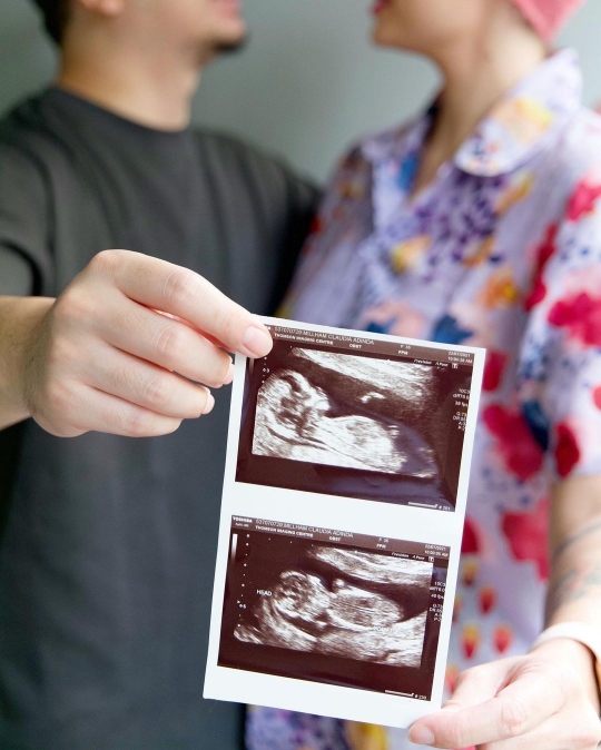Potret Bahagia Derby Romero saat Istri Umumkan kehamilan Anak Pertama