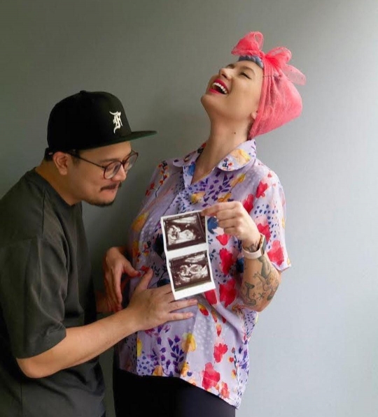 Derby Romero Umumkan Istri Tercinta Hamil Anak Pertama, Ini Potretnya