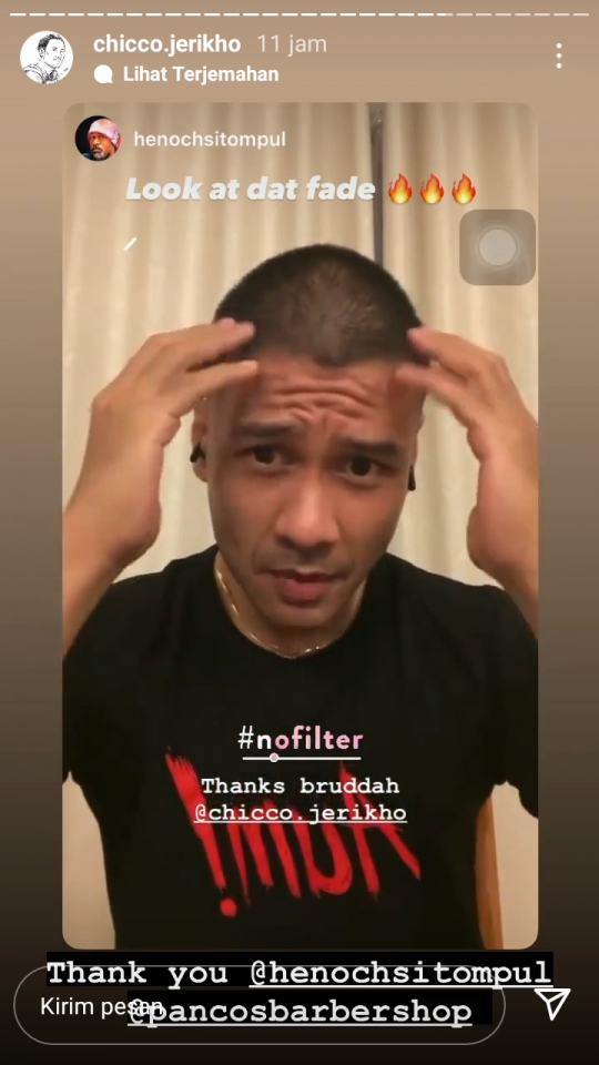 5 Potret Terbaru Chicco Jerikho dengan Rambut Botak, Beda Banget dan Bikin Pangling