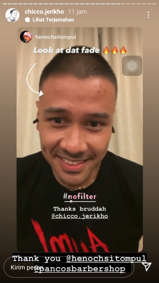 5 Potret Terbaru Chicco Jerikho dengan Rambut Botak, Beda Banget dan Bikin Pangling