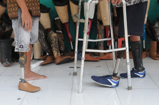 Semangat Penyandang Disabilitas Produksi Kaki Palsu