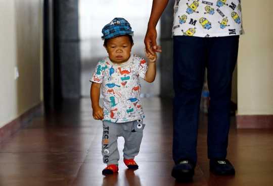 Remaja di Nepal dengan Tubuh Sebesar Bayi 1 Tahun