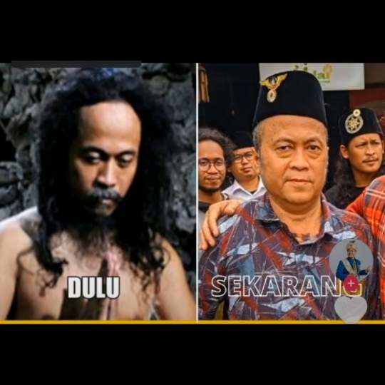 Masih Ingat Dukun Sakti Ki Joko Bodo, Usai Hijrah Kini Pakai Tongkat, Peci & Sarung