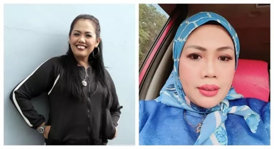 Deretan Foto Dulu dan Kini Elly Sugigi yang Bikin Pangling, Makin Cantik Dikira Oplas