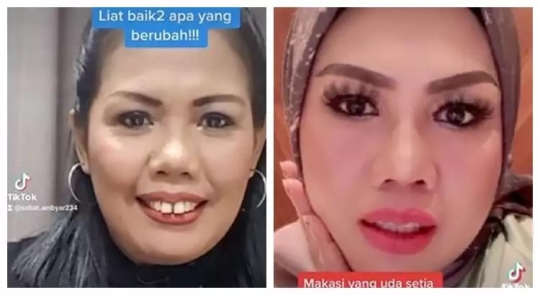 Deretan Foto Dulu dan Kini Elly Sugigi yang Bikin Pangling, Makin Cantik Dikira Oplas