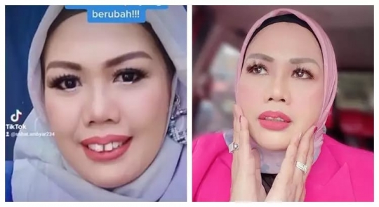 Deretan Foto Dulu dan Kini Elly Sugigi yang Bikin Pangling, Makin Cantik Dikira Oplas