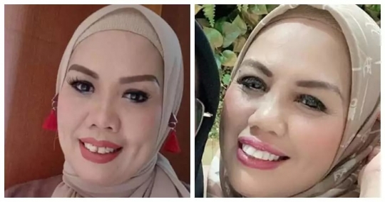 Deretan Foto Dulu dan Kini Elly Sugigi yang Bikin Pangling, Makin Cantik Dikira Oplas