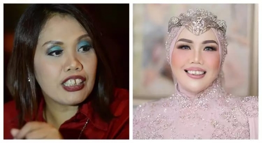 Deretan Foto Dulu dan Kini Elly Sugigi yang Bikin Pangling, Makin Cantik Dikira Oplas