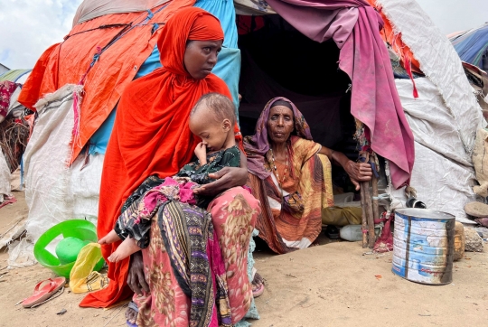 Potret Anak-Anak Somalia Menderita Gizi Buruk Akut