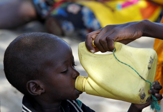 Potret Anak-Anak Somalia Menderita Gizi Buruk Akut