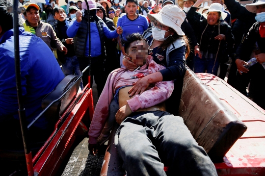 Bentrok Mematikan Polisi vs Pengunjuk Rasa di Bandara Peru, 17 Tewas