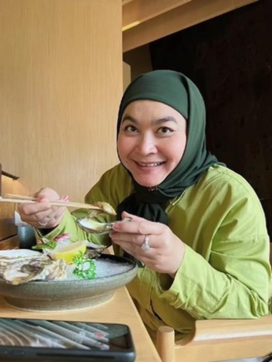 Jarang Tersorot, Intip Potret Terbaru Ulfa Dwiyanti yang Makin Cantik dengan Hijab