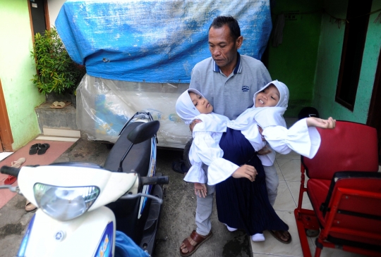 Potret Semangat Anak Kembar Siam di Garut Bercita-cita Ingin Jadi Dokter