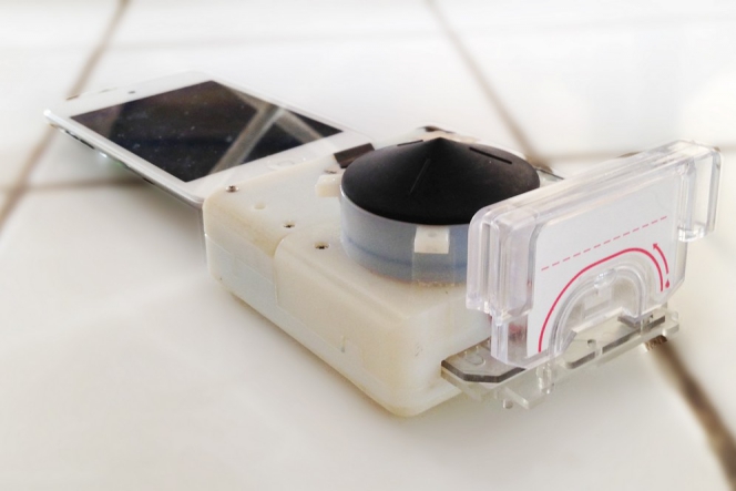 Wow, alat ini bisa bantu mendeteksi HIV dari smartphone!