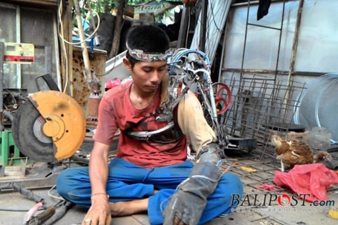 Kelumpuhan, pria asli Bali ini akhirnya buat lengan sendiri