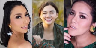 Artis-Artis Ini Semakin Cantik dengan Gigi Kelinci, Yang Mana Favorit Kamu?