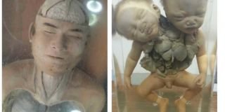 Bikin Merinding! Museum Siriraj, Bayi Hingga Otak Diawetkan Koleksi Aneh Galeri Medis