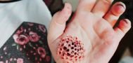 Buktikan Kamu Tak Memiliki Riwayat Trypophobia dengan Lihat 7 Gambar Ini,Berani Coba?