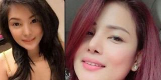 Inginnya lebih menawan, wanita cantik ini malah berakhir di meja operasi plastik