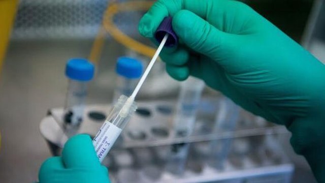 Kasus Gagal Ginjal Akut Misterius Ditemukan di Banyumas