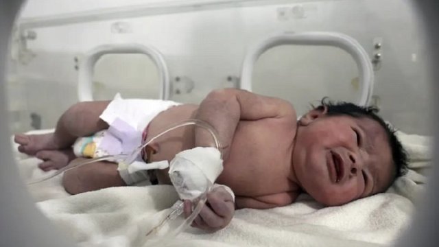 Aya dalam Kondisi Sehat, Ribuan Orang Ingin Adopsi Bayi Perempuan Ini