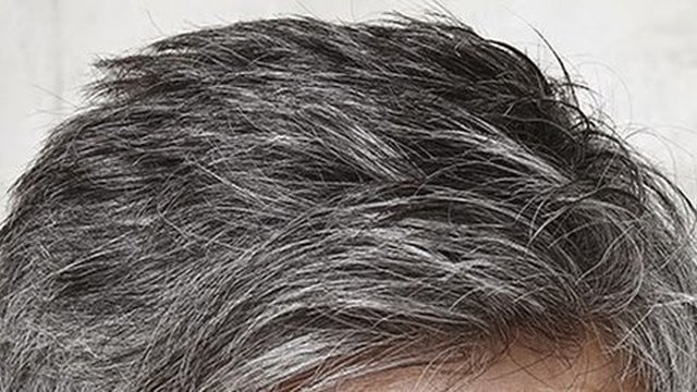 Tikus Pecahkan Teka-teki Mengapa Rambut Manusia Beruban