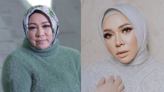 Melly Goeslaw Potong Lambung, Berat Badan Turun 34 Kg, Operasi Apakah Itu?