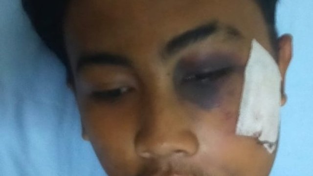 Aksi Brutal Gerombolan Remaja Bermotor, Kepala Pelajar Dilempar Botol