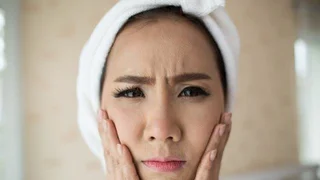 Bahaya, Ini 4 Efek Samping Pemakaian Krim Pemutih Wajah yang Perlu Kamu Tahu