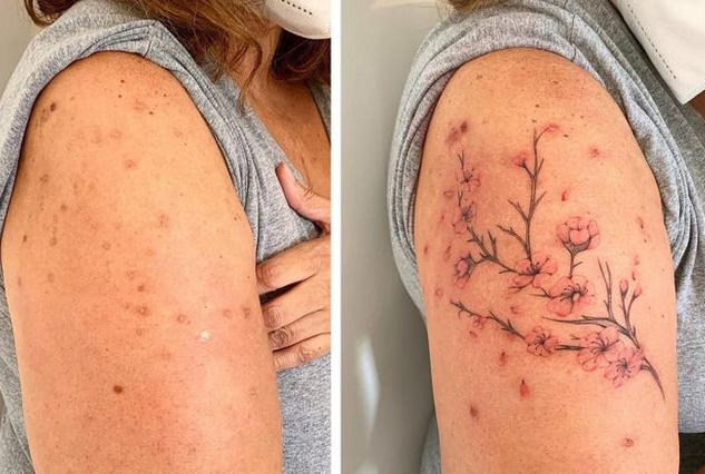 25 Scar Tattoos That Transform Old Wounds Into Beautiful Works Of