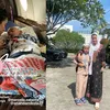 anak artis sakit langka