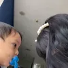 Kondisi Terbaru Gala